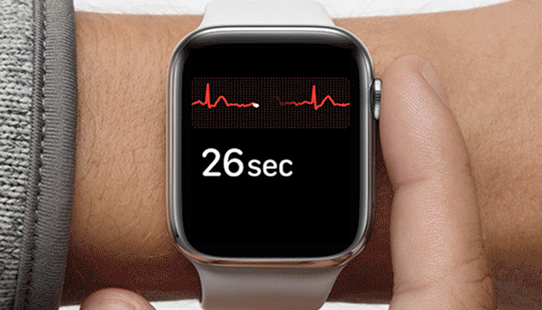 An Apple Watch Health Feature